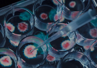 Close-up of a pipette placing experimental vaccine into a microplate.